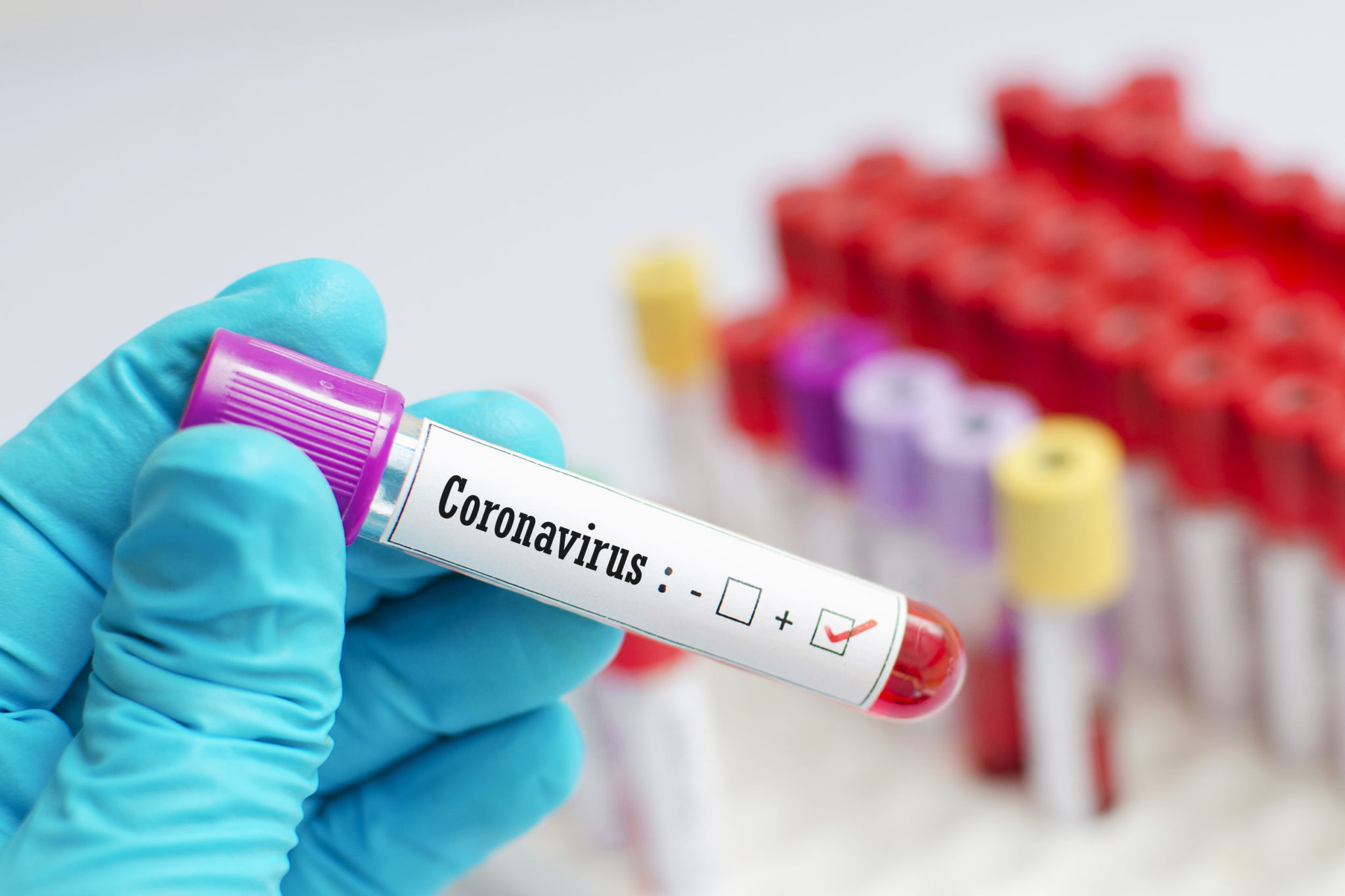 The Resurgence of Reshoring Due to the Coronavirus